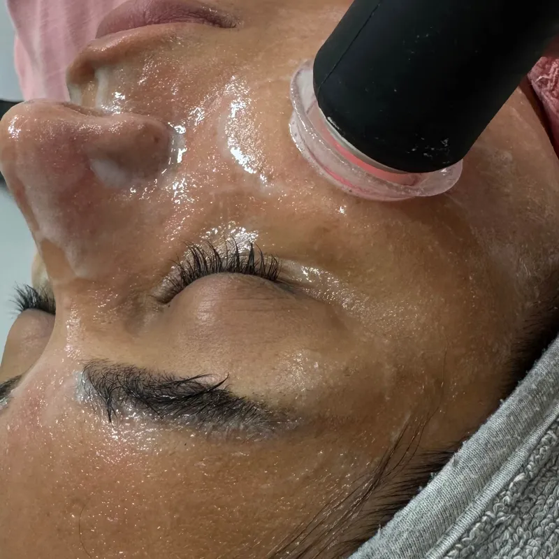 پلاژن تراپی