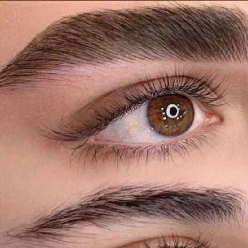 میکروبیگمنتیشن