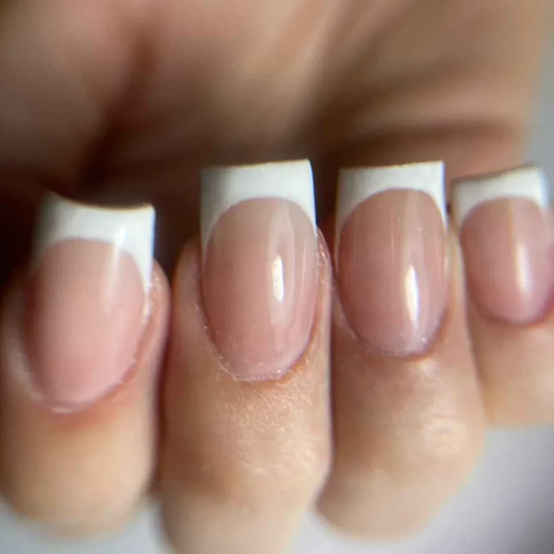 کاشت و لاک ژل