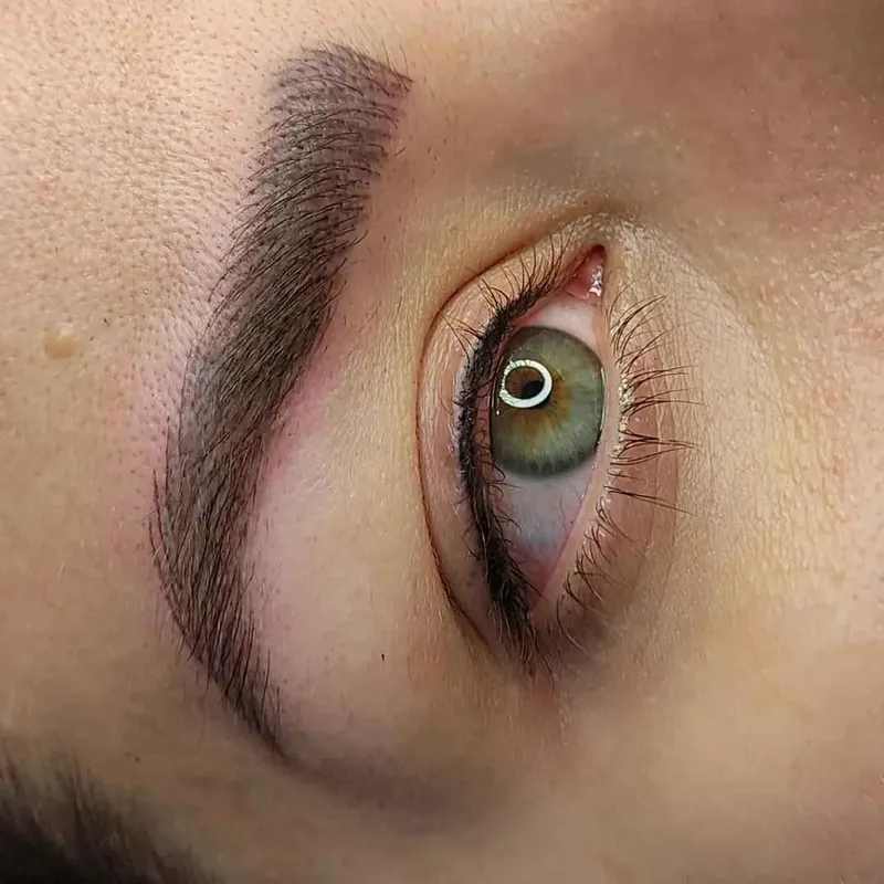 مدل فیبروزومیکروبلیدینگ نیازمندیم