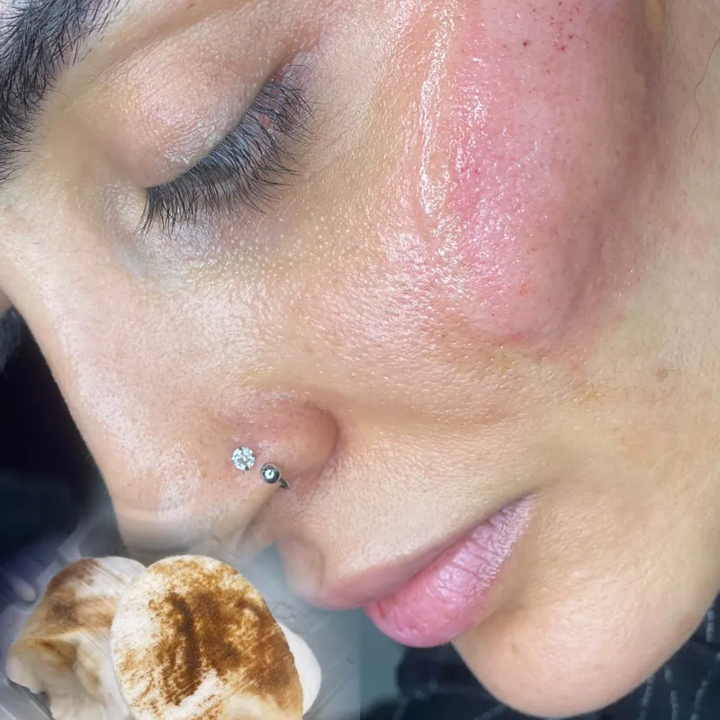 ریموو تتو رژگونه