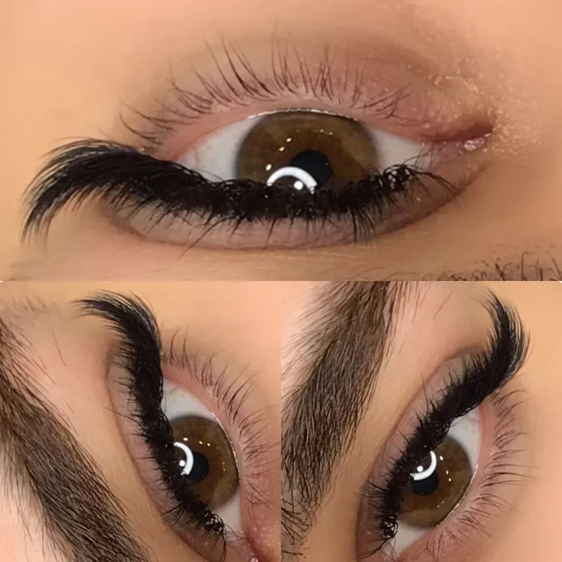 کاشت اولیه مژه