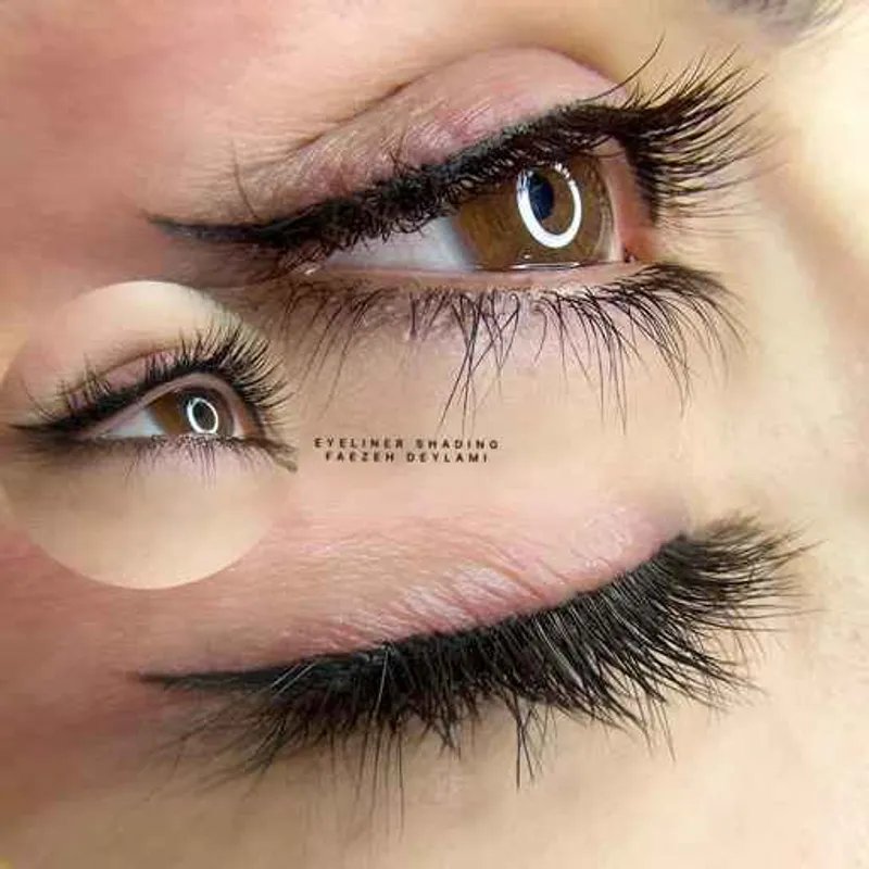 بنمژه دایم در اهواز