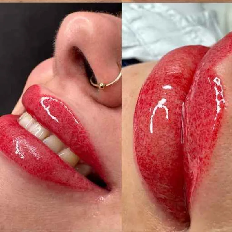 شیدینگ لب در اهواز