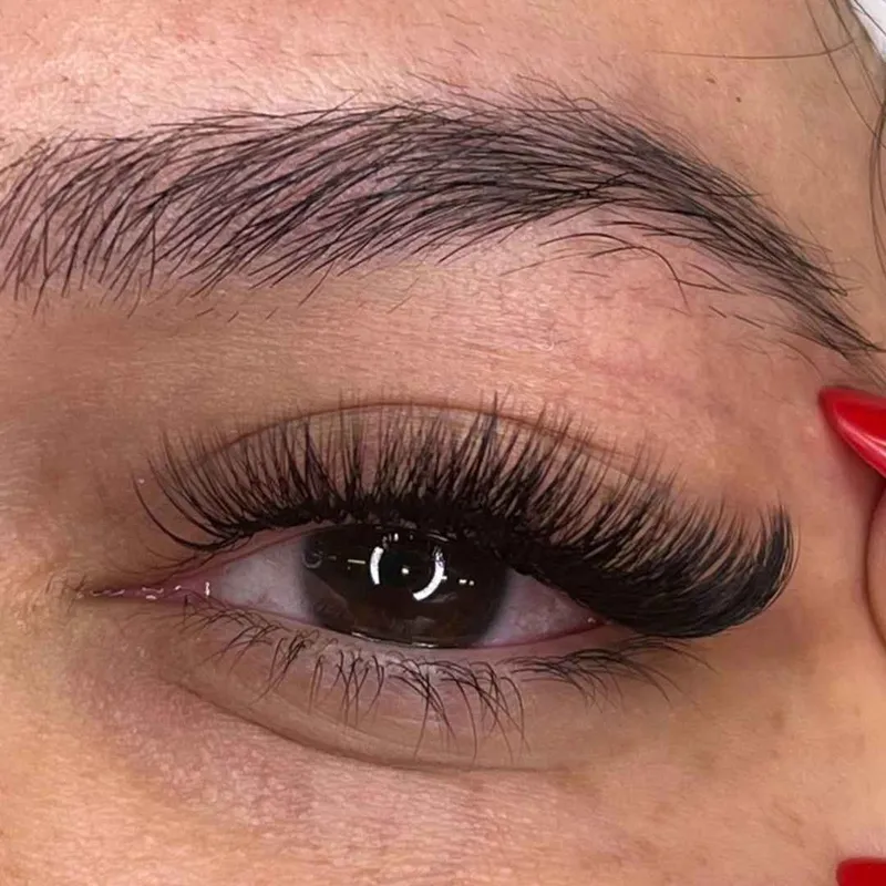 ترمیم والیوم پرحجم 