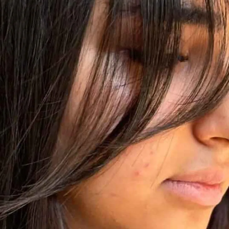 چتری پرده ای