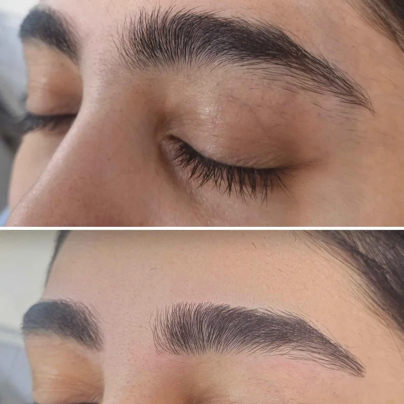 اصلاح فرم ابرو