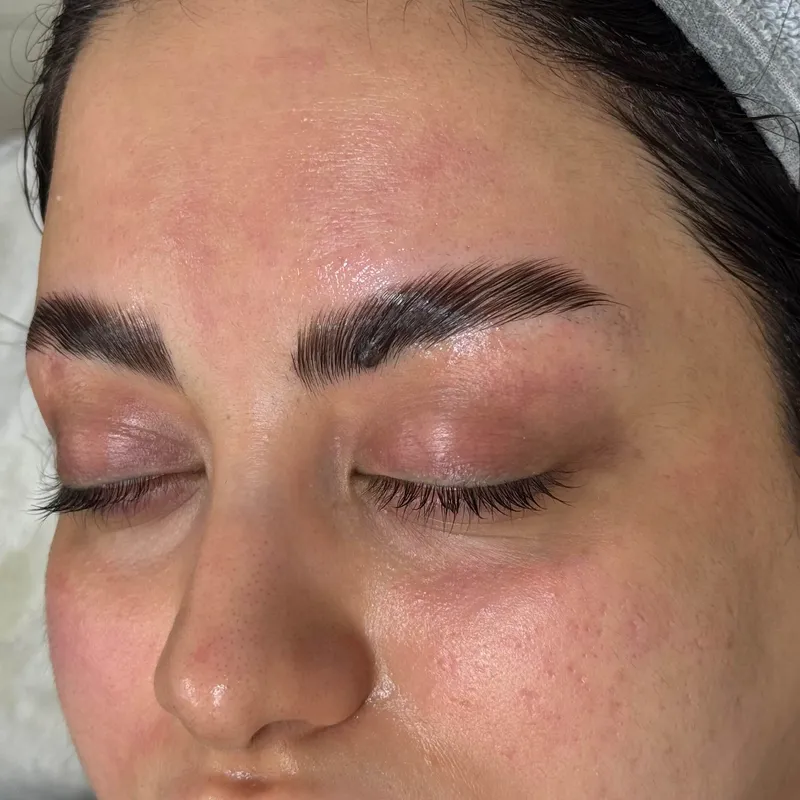 پاکسازی پوست و لیفت ابرو