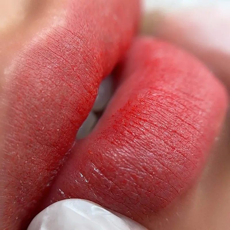 تنها شیدینگ لب بدون درد قم