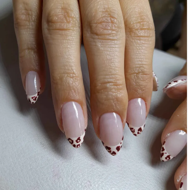 ترمیم ناخن پلنگی 