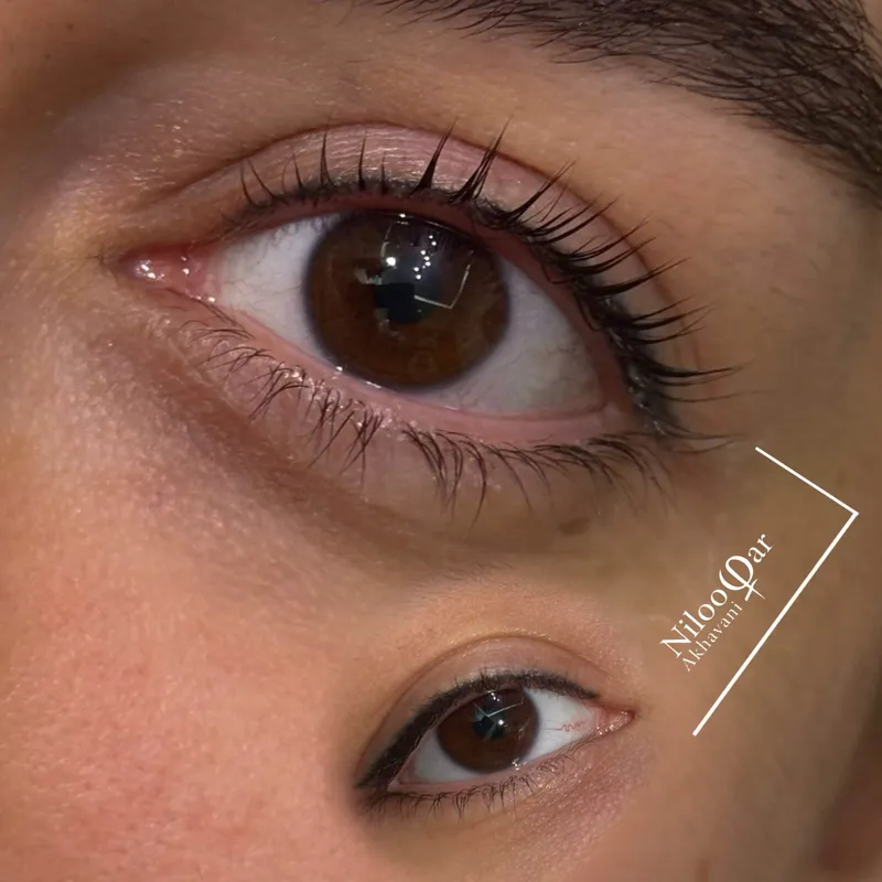 لیفت و لیمنت مژه