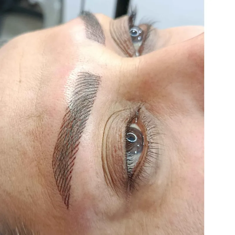 میکروبلیدینگ 