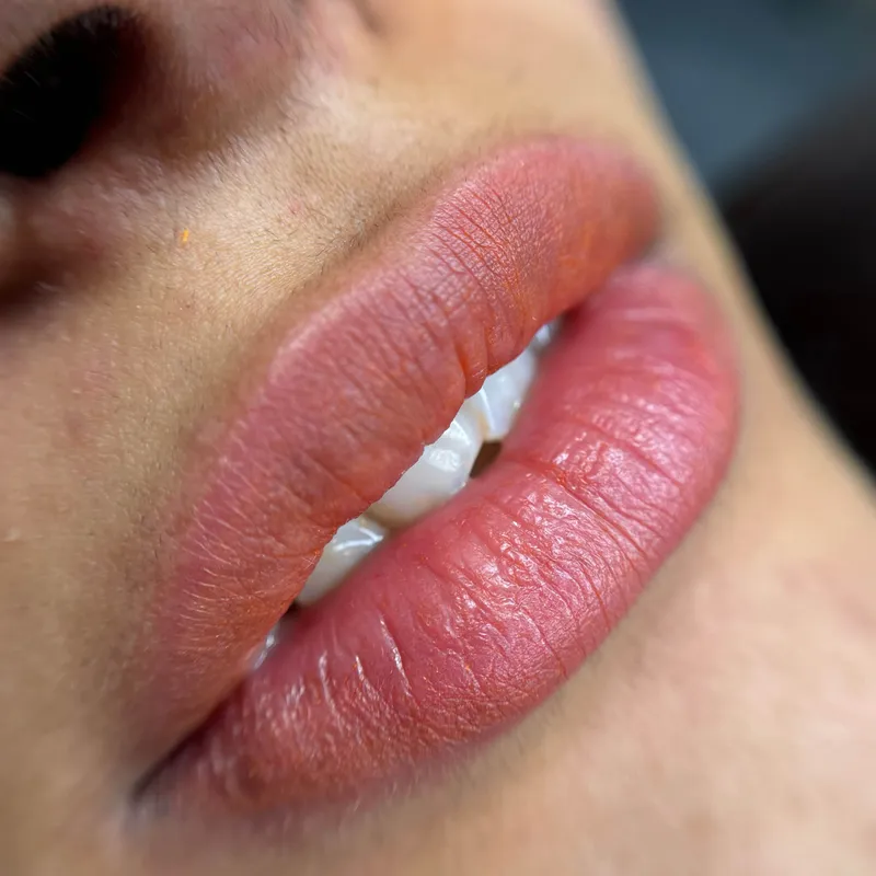 شیدینگ لب قم رفع تیرگی لب قم