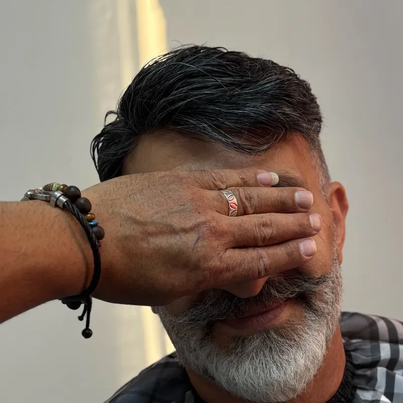 پروتز مو جوگندمی