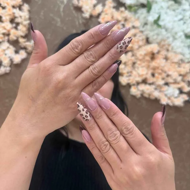 ترمیم و طراحی 