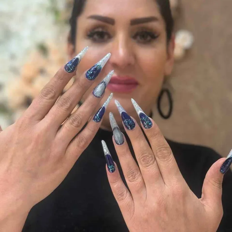 کاشت ژورنالی 