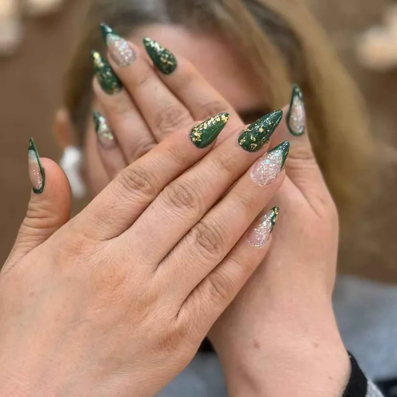 کاشت ژورنالی