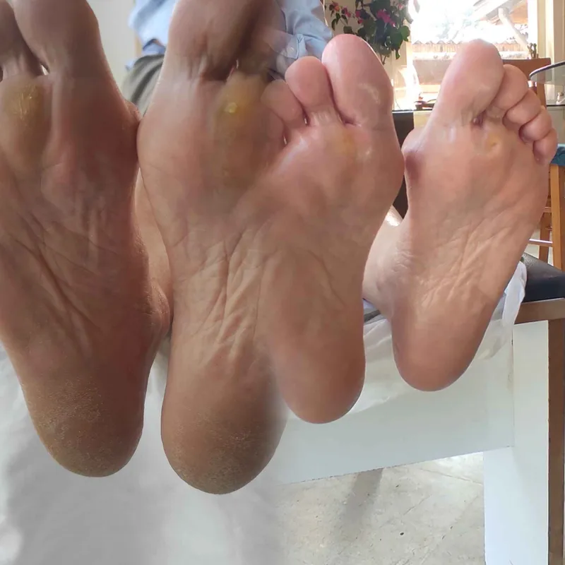 پدیکور درمانی