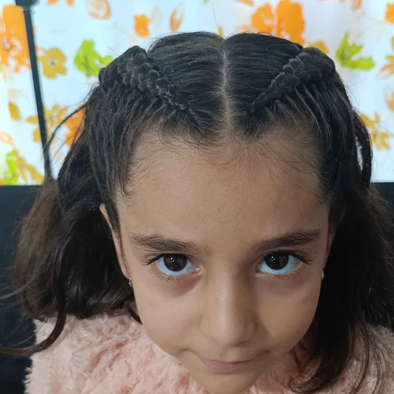 بافت جلوی مو