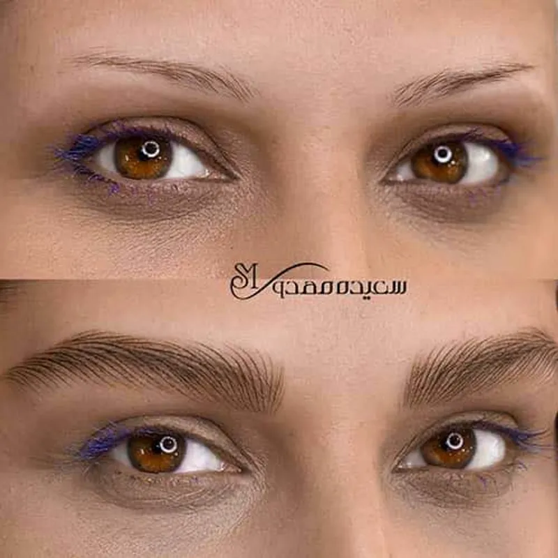 فیبروز ابرو