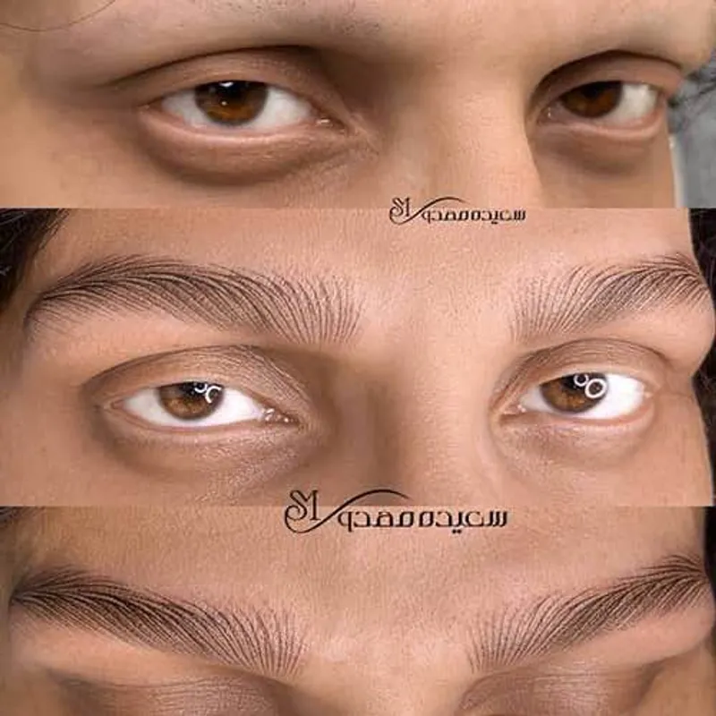 هیراستروک ازرو