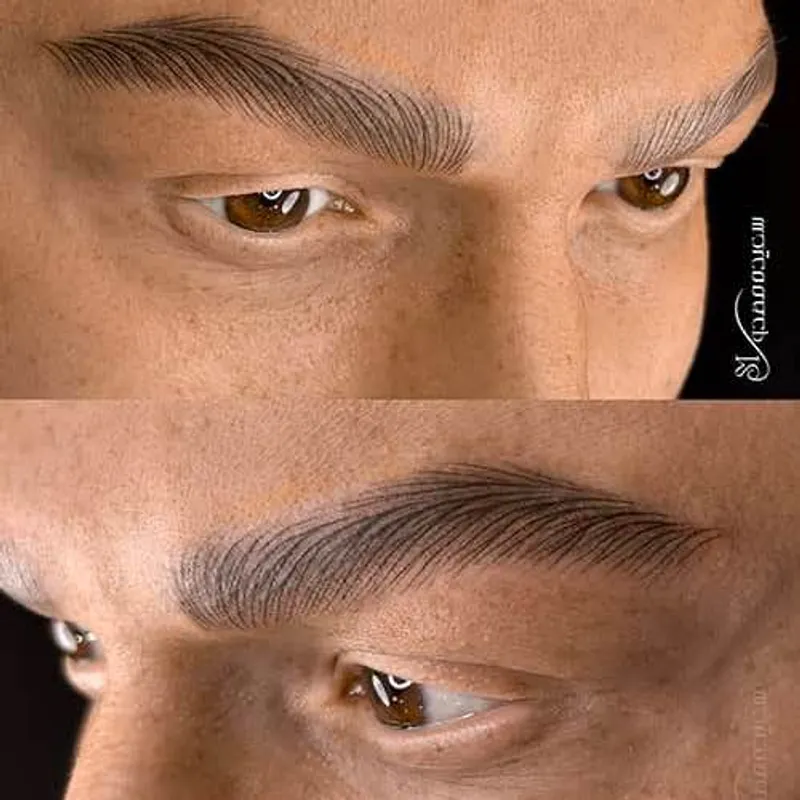 فیبروز ابرو