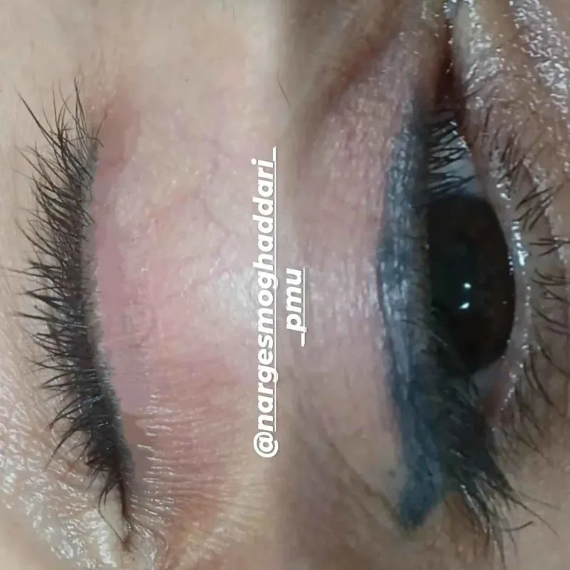 ریموو  خط چشم