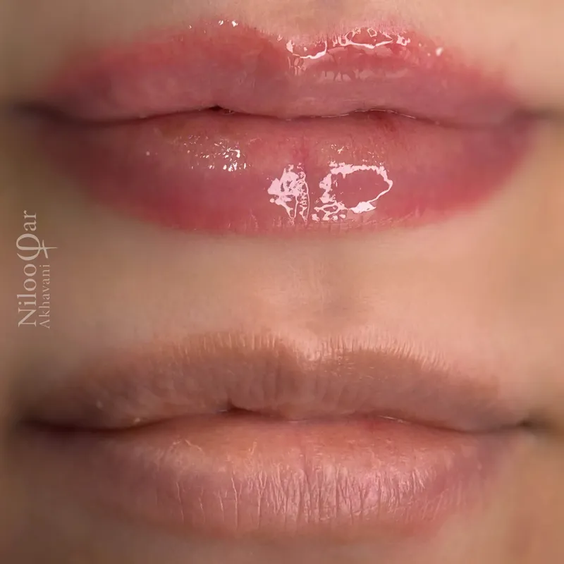 ماندگارى شيدينگ لب