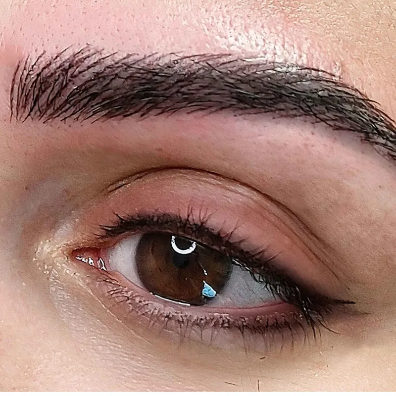 میکرو بلیدینگ