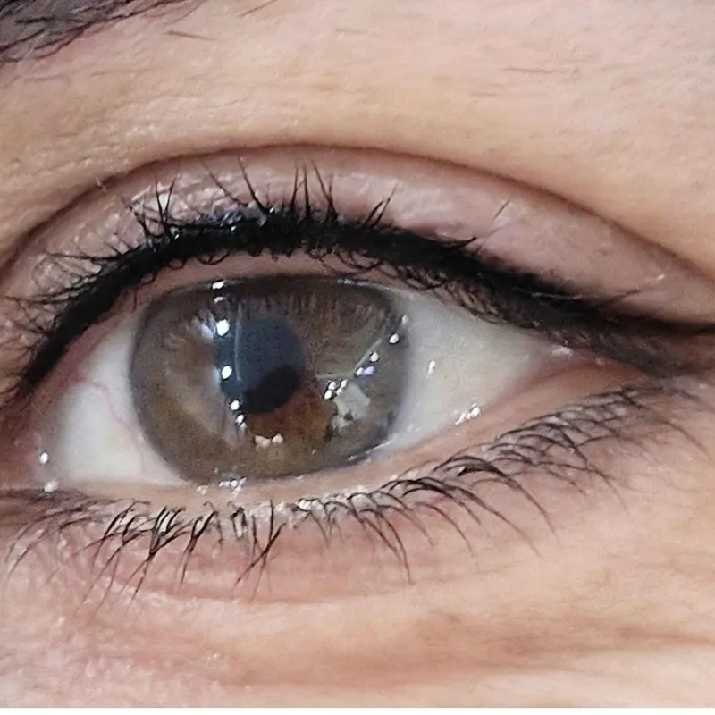 خطچشم مینیاتوری 