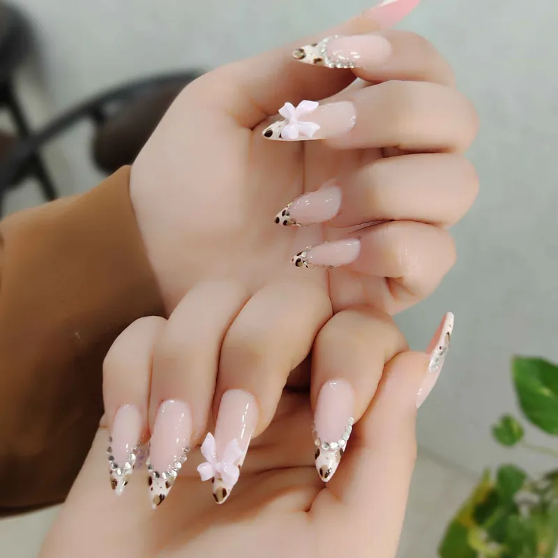 کاشت ژل