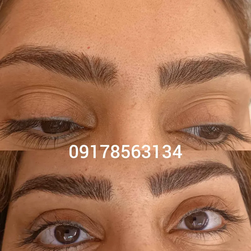 ترمیم فیبروز