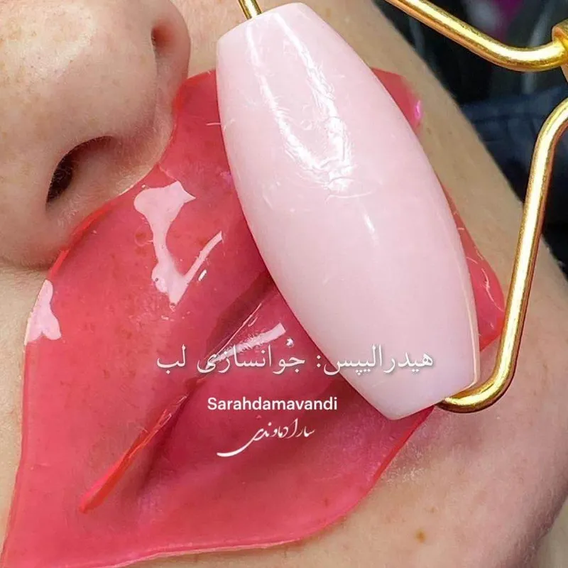 هیدرالیپس لب 