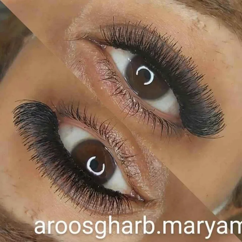 کاشت مژه