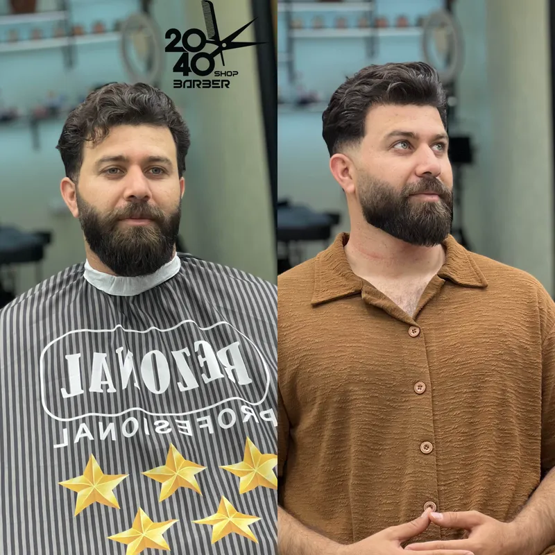 فید ، فید و فرم دهی ریش