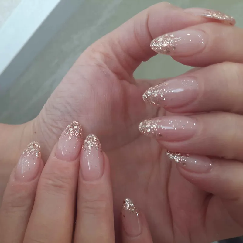 ترمیم ژلیش 