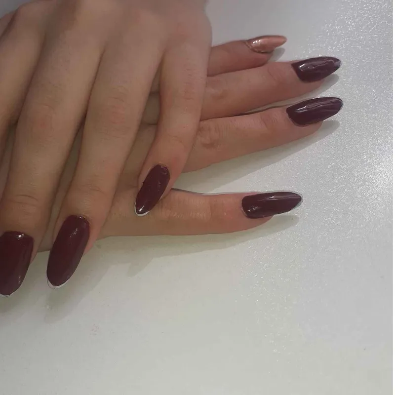 کاشت ژلتیپس