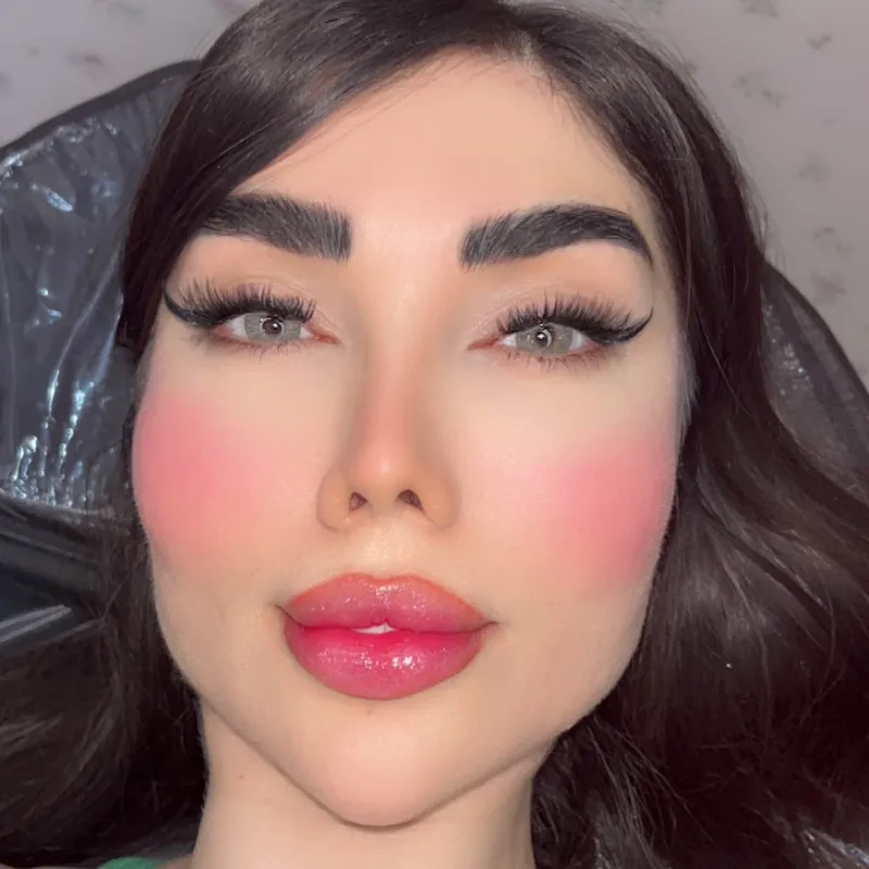 کاشت ژورنالی هیدن 