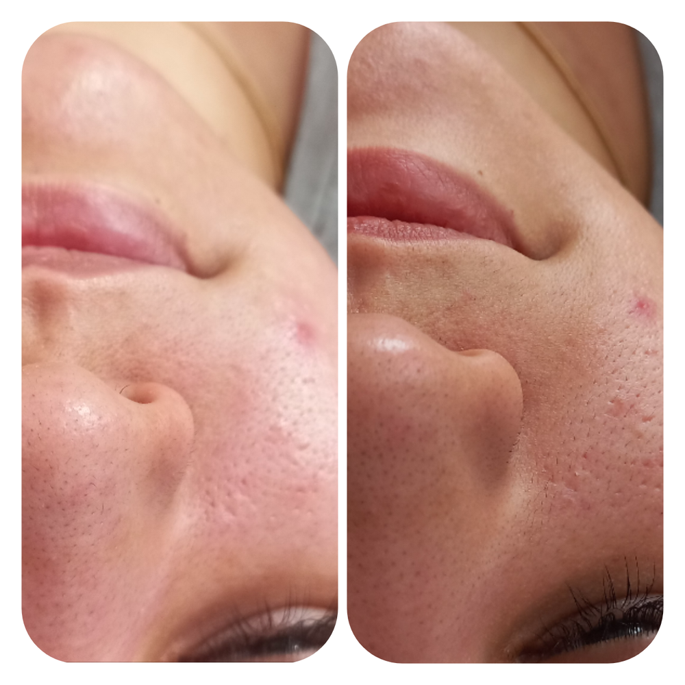 فیشیال تخصصی جوش 