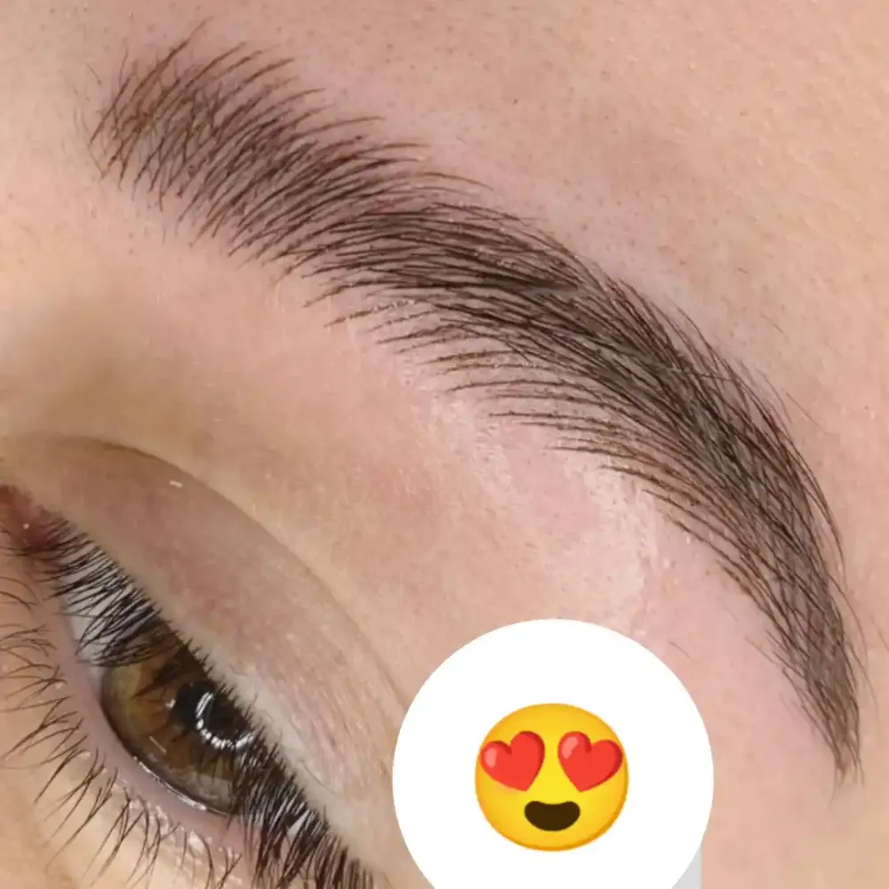 فیبروز ابرو 