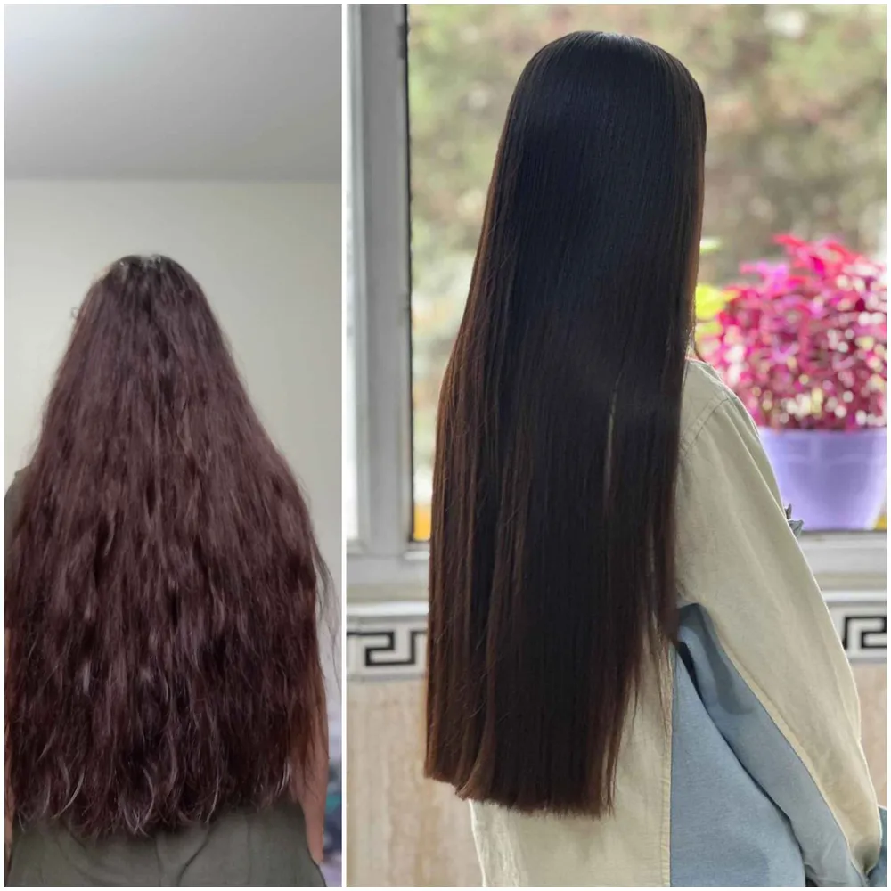 پروتئین تراپی 