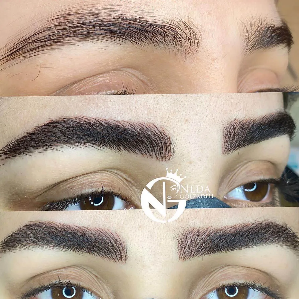 میکروبلیدینگ