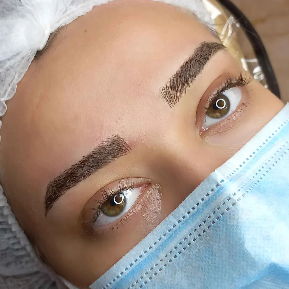 میکروبلیدینگ به سبک فیبروز