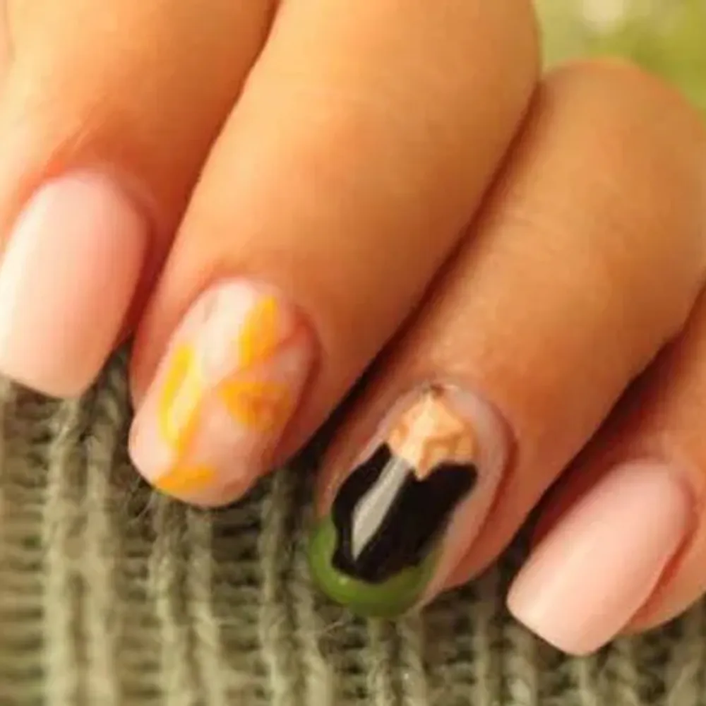 کاشت پلی ژل 