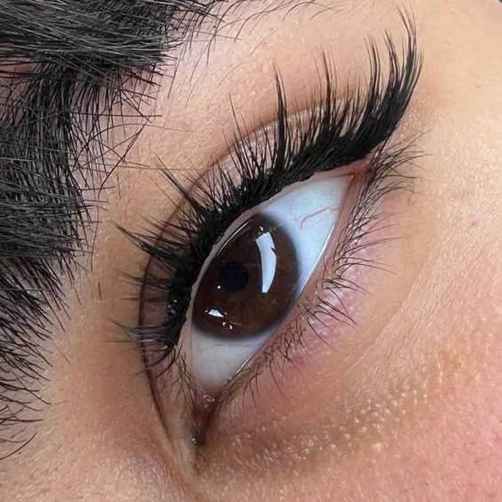 کاشت مژه کایلی