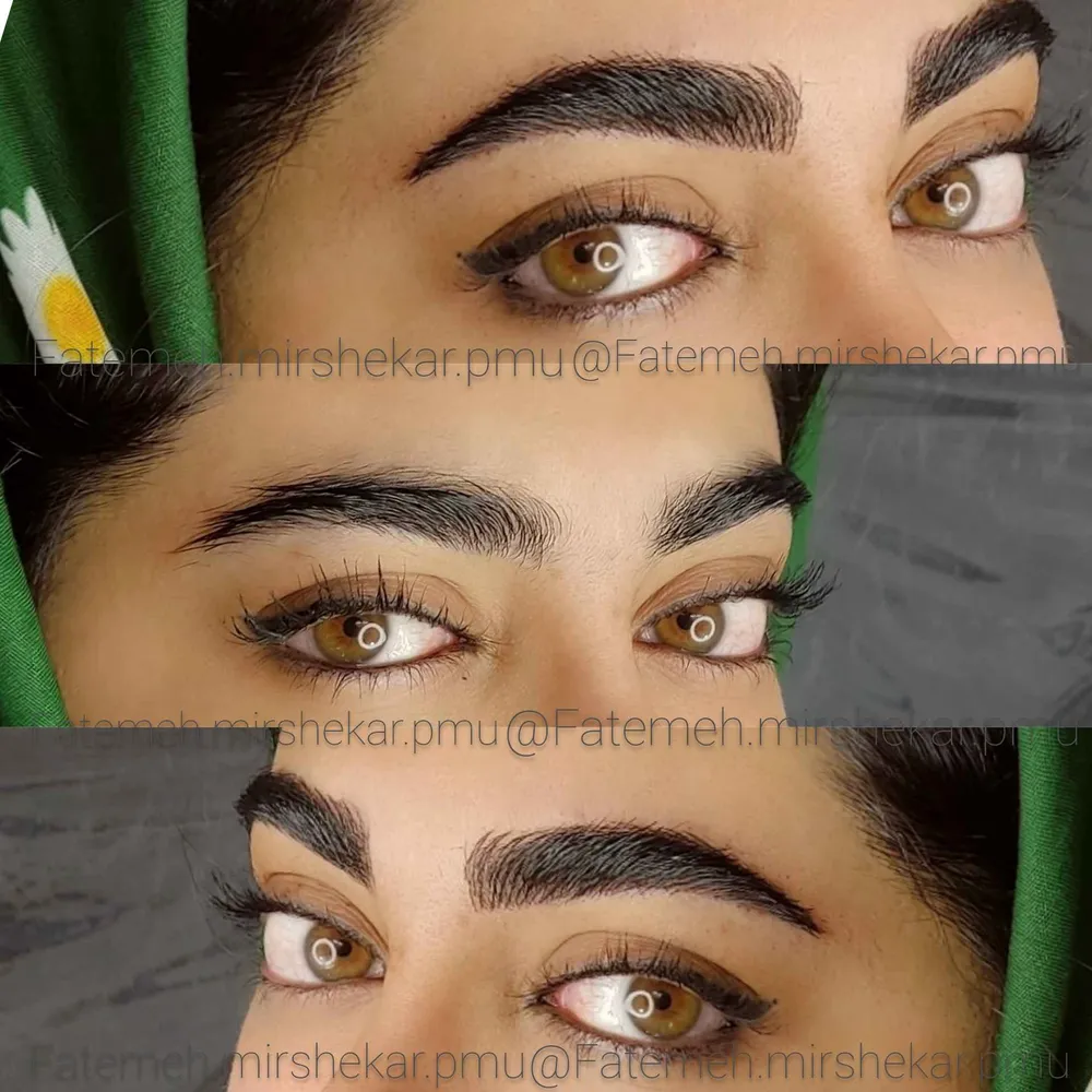 میکرو بلیدینگ