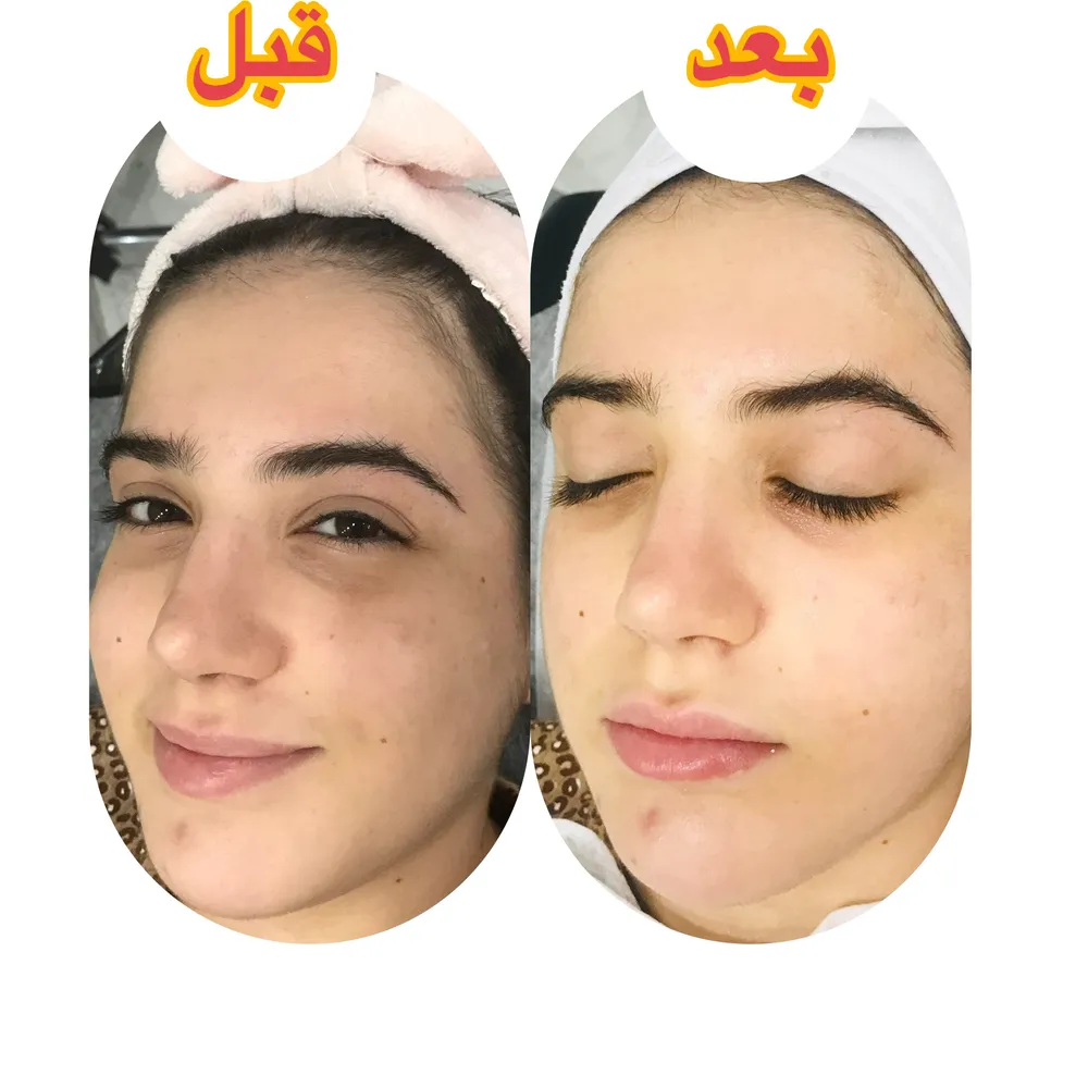 فیشال 