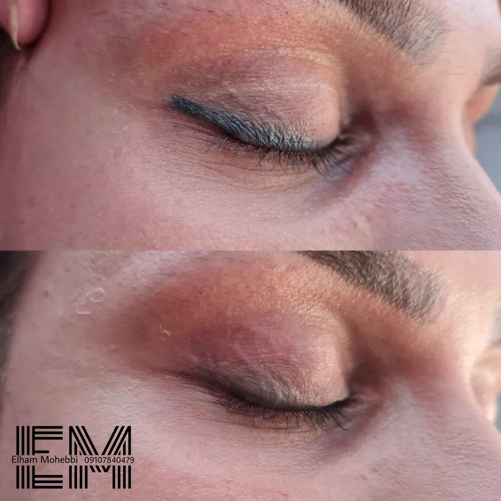 ریموو خط چشم