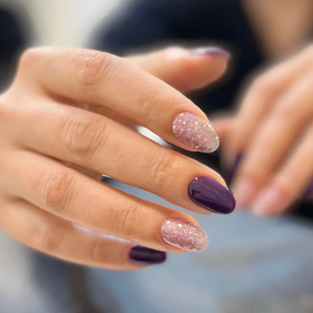 ترمیم پلی ژل