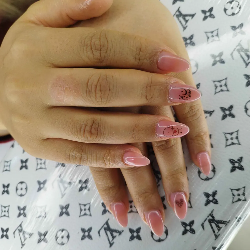 کاشت ژل دلبر